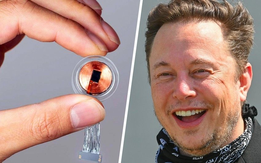 Elon Musk says the first human has received an implant from