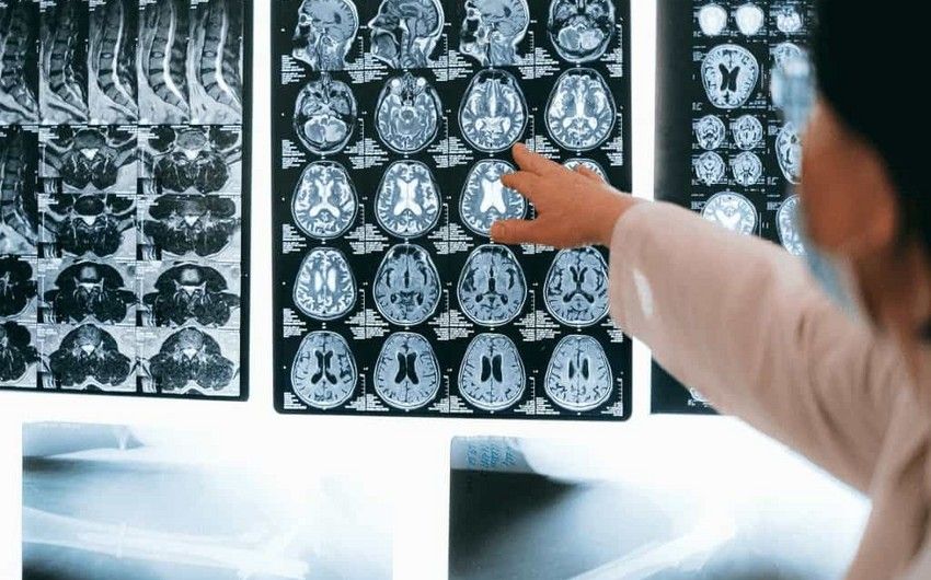 Russia, Italy create project to study work of genes in brain cancer cells